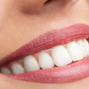 Esthétique du sourire